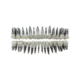 DENTES COROA DE RESINA E RAIZ DE METAL C/28 COR 60